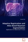 Adaptive Registration and Atlas Based Bayesian Segmentation - Book