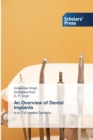 An Overview of Dental Implants - Book