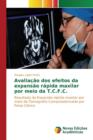 Avaliacao DOS Efeitos Da Expansao Rapida Maxilar Por Meio Da T.C.F.C. - Book