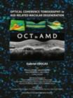 Optical Coherence Tomography in Age-Related Macular Degeneration - eBook