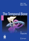 Temporal Bone : An Imaging Atlas - eBook