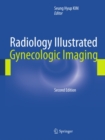 Radiology Illustrated: Gynecologic Imaging - eBook