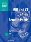 MRI and CT of the Female Pelvis - Book