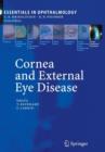 Cornea and External Eye Disease : Corneal Allotransplantation, Allergic Disease and Trachoma - Book