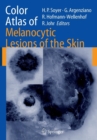 Color Atlas of Melanocytic Lesions of the Skin - Book