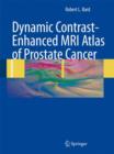 Dynamic Contrast-Enhanced MRI Atlas of Prostate Cancer - Book