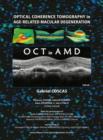 Optical Coherence Tomography in Age-Related Macular Degeneration - Book