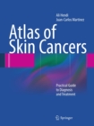 Atlas of Skin Cancers : Practical Guide to Diagnosis and Treatment - eBook