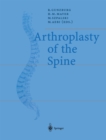 Arthroplasty of the Spine - eBook