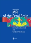 MRI of the Fetal Brain : Normal Development and Cerebral Pathologies - eBook