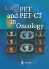PET and PET-CT in Oncology - eBook