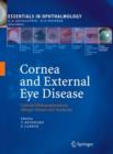 Cornea and External Eye Disease : Corneal Allotransplantation, Allergic Disease and Trachoma - Book