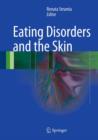 Eating Disorders and the Skin - eBook