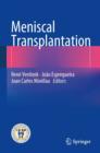 Meniscal Transplantation - Book