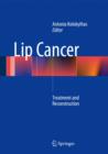 Lip Cancer : Treatment and Reconstruction - Book