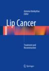 Lip Cancer : Treatment and Reconstruction - eBook