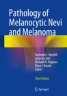 Pathology of Melanocytic Nevi and Melanoma - eBook