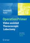 Video - assisted Thoracoscopic Lobectomy - Book