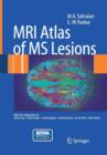 MRI Atlas of MS Lesions - Book