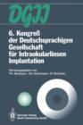 6. Kongress Der Deutschsprachigen Gesellschaft Fur Intraokularlinsen Implantation : 6. Bis 7. Marz 1992, Munchen - Book