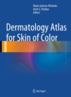 Dermatology Atlas for Skin of Color - eBook
