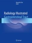 Radiology Illustrated: Gastrointestinal Tract - Book