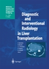 Diagnostic and Interventional Radiology in Liver Transplantation - eBook