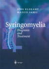 Syringomyelia : Diagnosis and Treatment - eBook