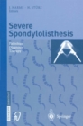 Severe Spondylolisthesis : Pathology - Diagnosis - Therapy - eBook