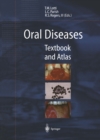 Oral Diseases : Textbook and Atlas - eBook