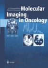 Molecular Imaging in Oncology : PET, MRI, and MRS - eBook