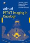 Atlas of PET/CT Imaging in Oncology - Book