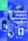 Radiological Imaging in Hematological Malignancies - Book