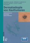 Dermatoskopie Von Hauttumoren : Auflichtmikroskopie -- Dermoskopie -- Digitale Bildanalyse - Book