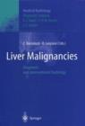 Liver Malignancies : Diagnostic and Interventional Radiology - Book