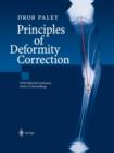 Principles of Deformity Correction - Book