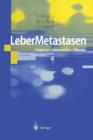 LeberMetastasen : Diagnose - Intervention - Therapie - Book