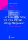 Carcinoma of the Kidney and Testis, and Rare Urologic Malignancies : Innovations in Management - Book