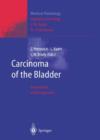 Carcinoma of the Bladder : Innovations in Management - Book