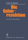Die Colonresektion - Book