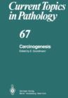Carcinogenesis - Book
