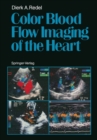 Color Blood Flow Imaging of the Heart - eBook