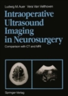 Intraoperative Ultrasound Imaging in Neurosurgery : Comparison with CT and MRI - Book