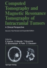 Computed Tomography and Magnetic Resonance Tomography of Intracranial Tumors : A Clinical Perspective - eBook