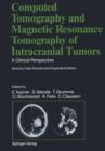 Computed Tomography and Magnetic Resonance Tomography of Intracranial Tumors : A Clinical Perspective - Book