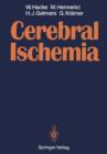 Cerebral Ischemia - Book