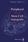Peripheral Blood Stem Cell Autografts - eBook