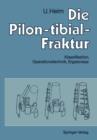 Die Pilon-tibial-Fraktur - Book