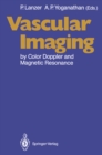 Vascular Imaging by Color Doppler and Magnetic Resonance - eBook