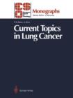 Current Topics in Lung Cancer - Book